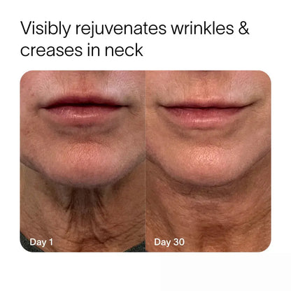 Virelli™ - 4-in-1 Skincare Wand Kit Nydras